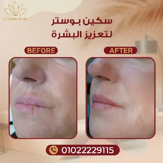  مير سكين بوستر سيروم 50 ملي