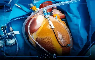 قسطره كلي ثنائيه