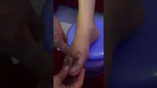 Gargle antimicrobial