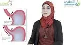 فينديفان 50مجم 25 اقراص
