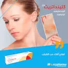 كلينداتريتين جل موضعي 30 جم