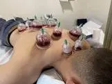 ISLAMIC CUPPING SMALL