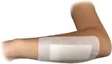 WOUND ADHESIVE PARTS 10*25