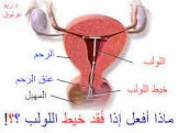 ايجي تي لولب داخل الرحم